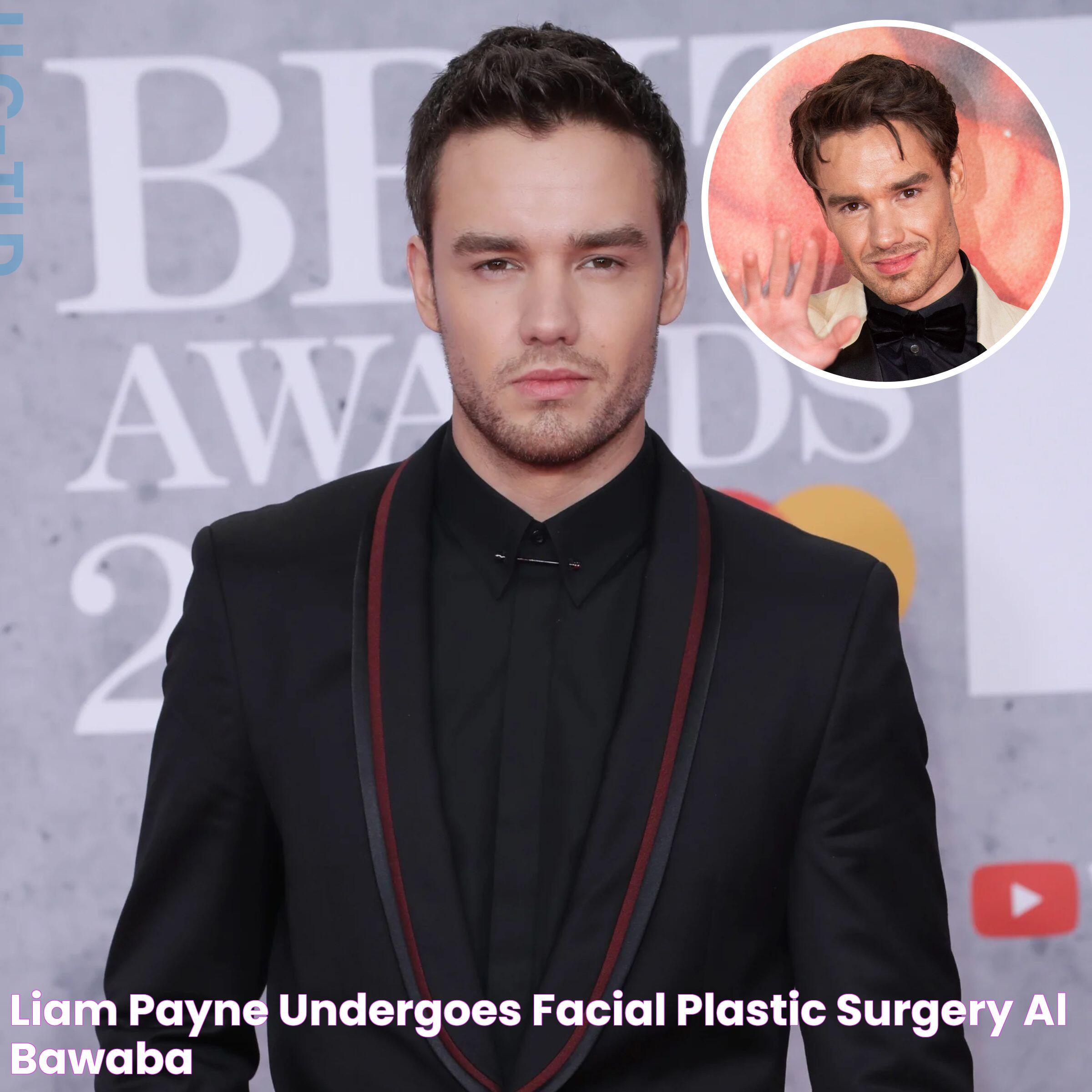 Liam Payne undergoes facial plastic surgery Al Bawaba