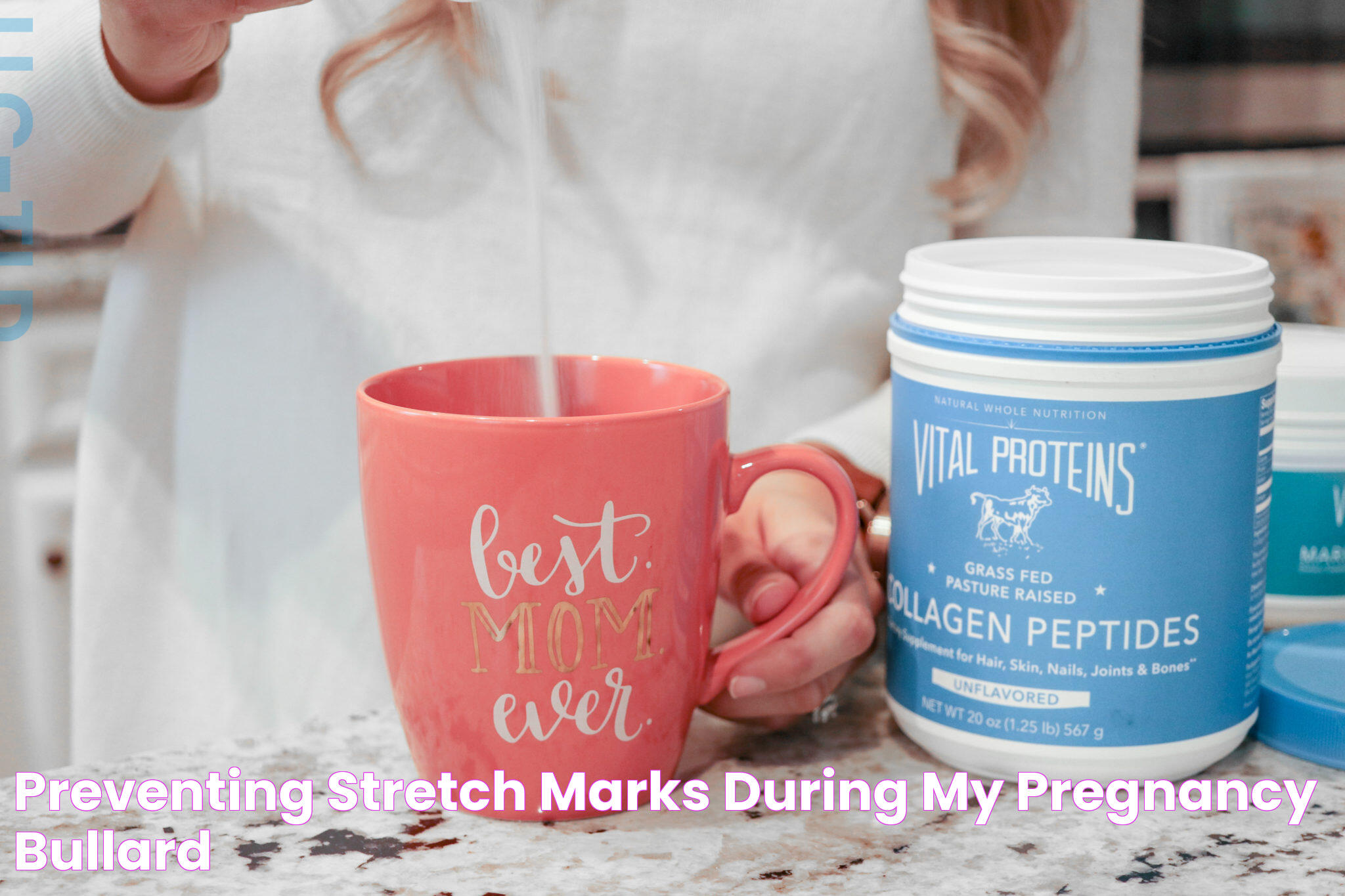 Preventing Stretch Marks During My Pregnancy Bullard