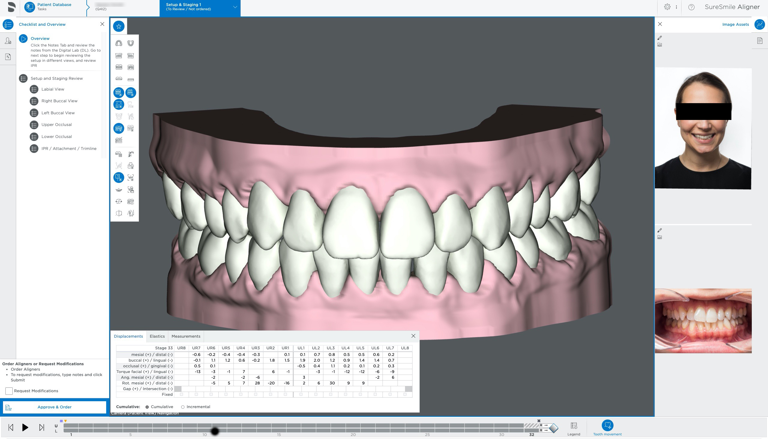 Dentsply Sirona presents SureSmile® Aligner Software upgrades for an